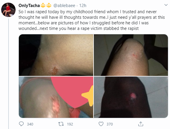 I was raped by my trusted childhood friend, lady cries out