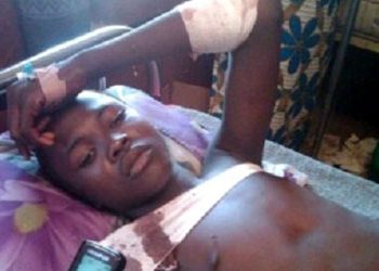 How My School Mates Were Killed – Survivor Of Yobe Massacre Speaks (PICTURED)