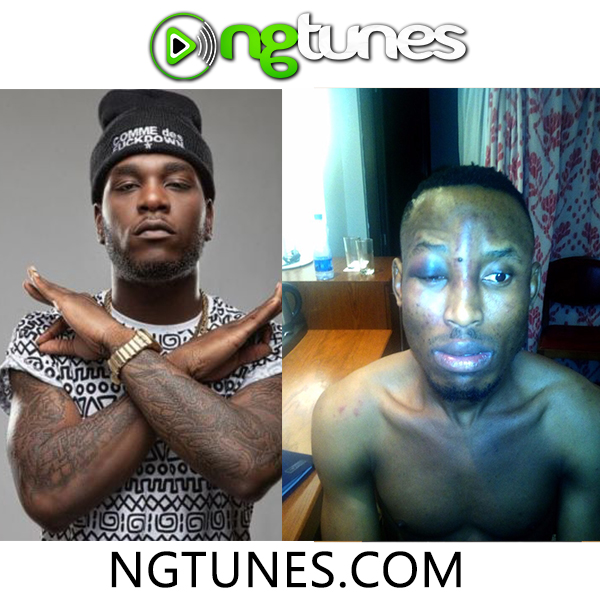 Burna Boy Wanted For Robbery and Assault on Mr 2Kay