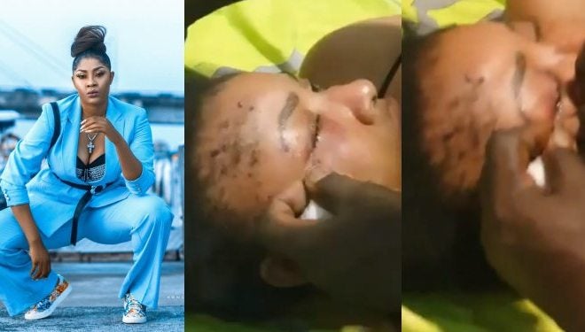 Regina Askia Cautions Angela Okorie After Medical Personnel Removes Pellets From Her Face With Bare-hands