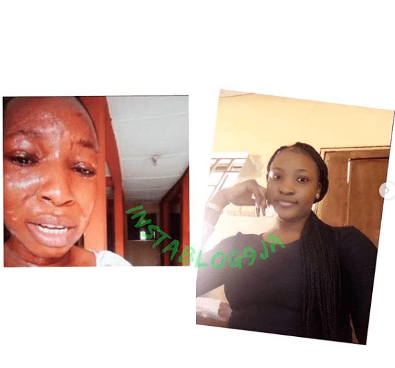 Student Allegedly Bites Off Her Roommate’s Ear In Osun University