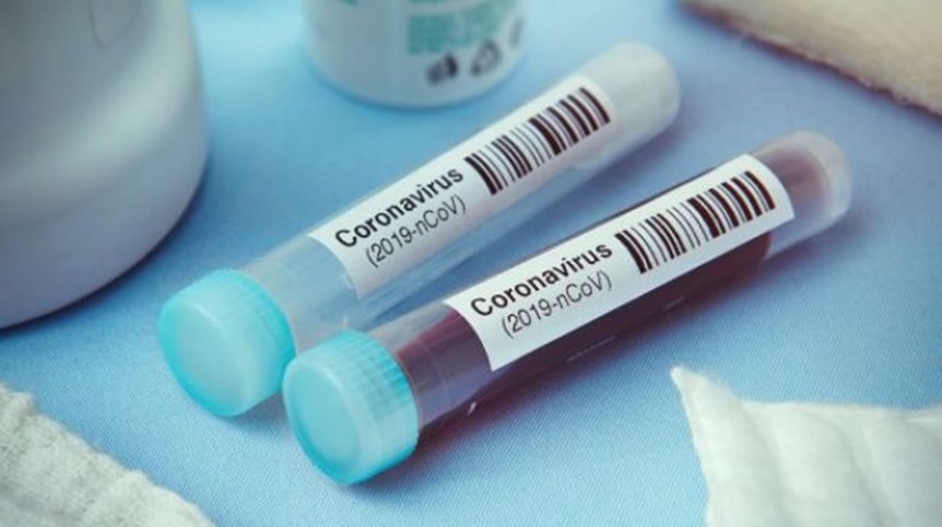 Nigeria has only tested 178 people for coronavirus even though there is contact tracing for 4,370 people