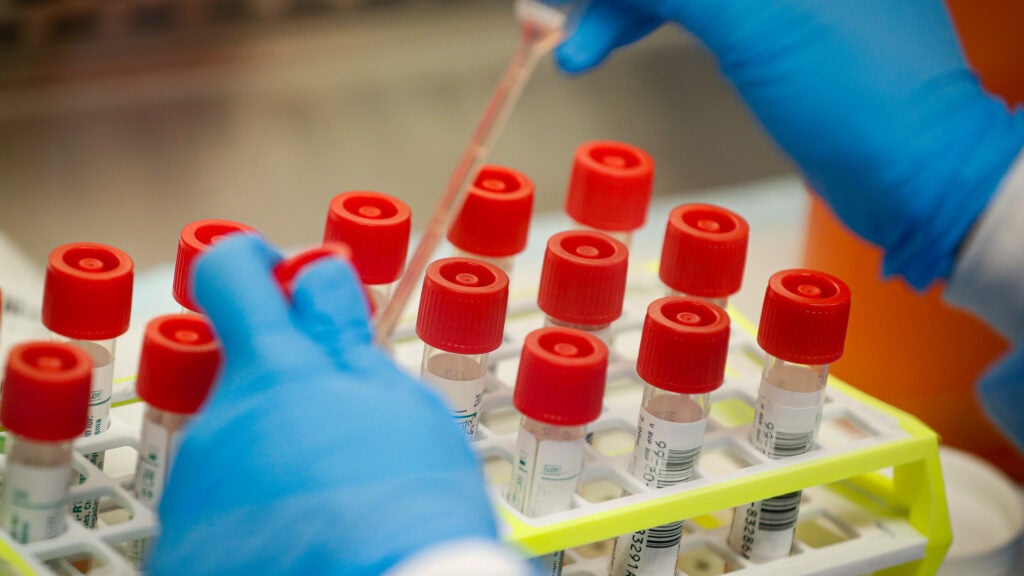 Kwara confirms two cases of Coronavirus