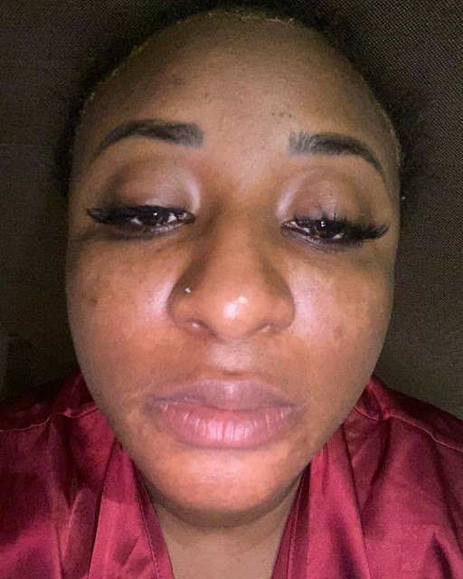 Actress Ini Edo Denies Bleaching And Explains Why Her Face Is Discolored.