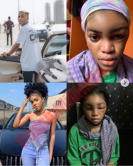 Lil Frosh Brutality Beat His Girlfriend, Left Her Face Disfigured