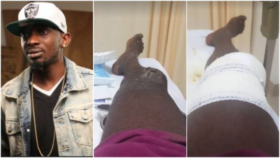 May D suffers burn injury as fire guts his house
