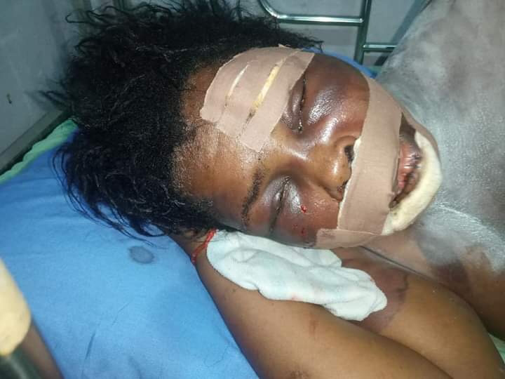 Yahoo Boy Tries To Pluck Out His Mother’s Eyes For Rituals In Delta